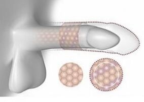 Suurenenud peenis mahult