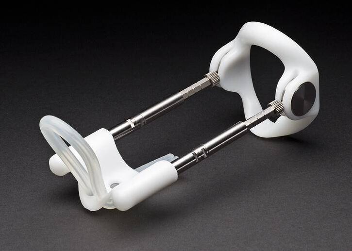 pikendaja pärast peenise suurendamise operatsiooni